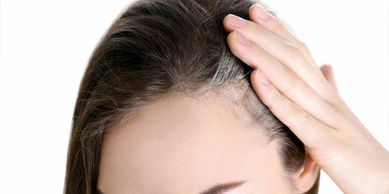I capelli bianchi possono tornare del loro colore originale?