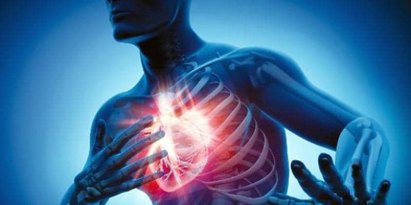 infarto