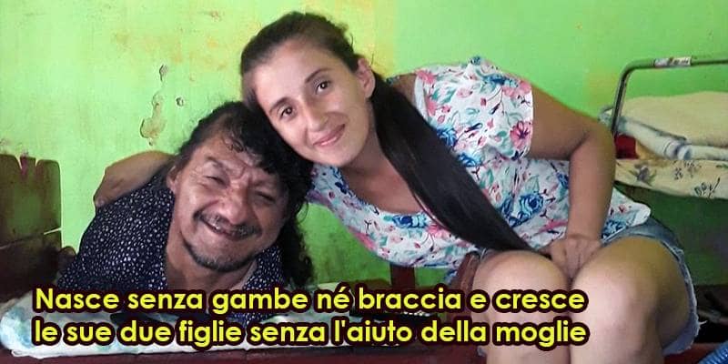 Nasce senza gambe e braccia, e cresce le sue 2 figlie da solo