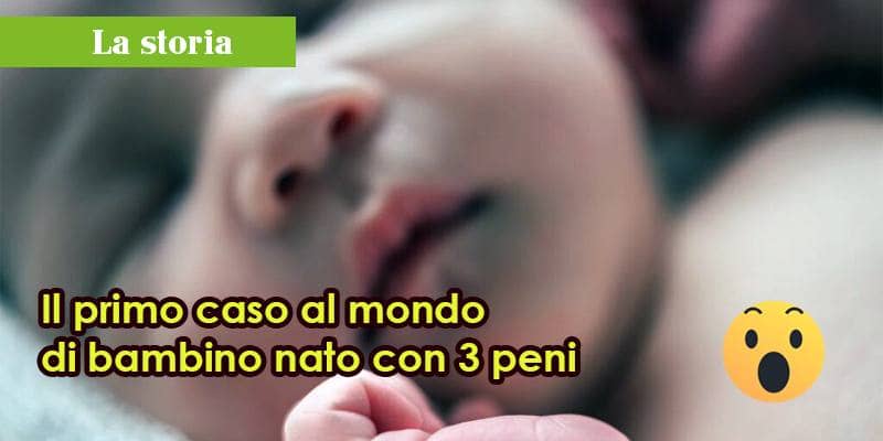 Il primo caso al mondo di bambino nato con 3 peni