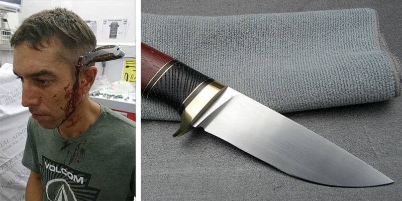 coltello nella testa