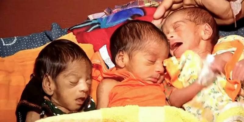 Dà alla luce un bimbo prematuro e 27 giorni dopo partorisce altri 2 gemelli