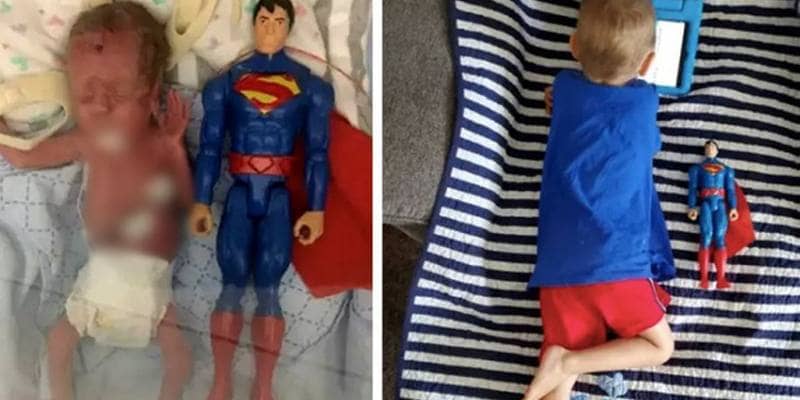 Bimbo prematuro piccolo quanto un pupazzo di Superman